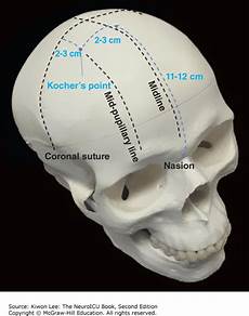 Shunt and Series Reactors